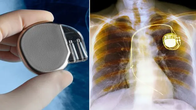 can a cordless drill interfere with a pacemaker
