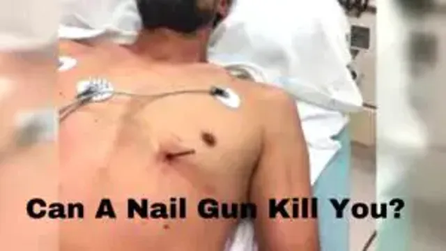 can a staple gun kill you