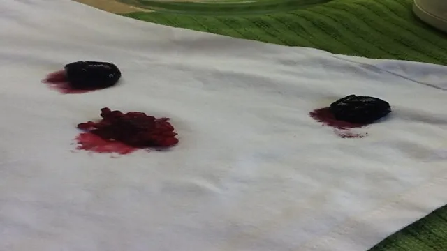 how to get berry stains out of wood